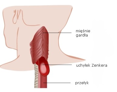 UCHYŁEK